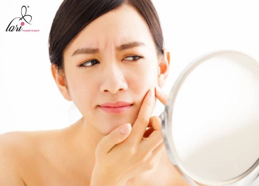 Thường xuyên nặn ép mụn khi các nốt mụn li ti xuất hiện trên da cũng là nguyên nhân nổi mụn bọc