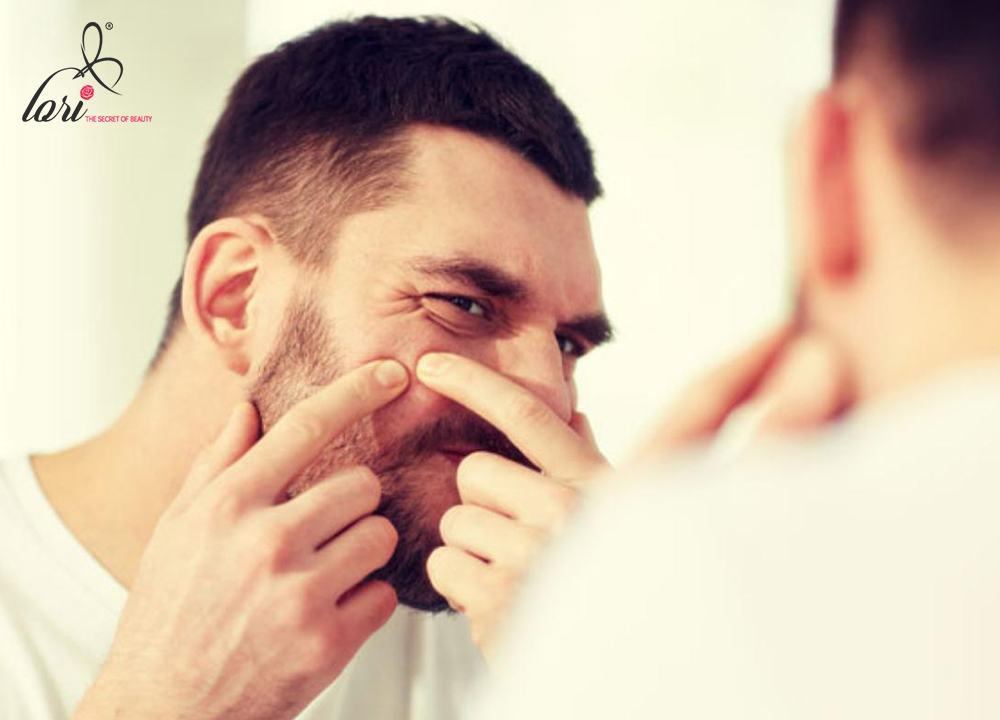 Thói quen dùng tay nặn mụn cũng vô tình tạo điều kiện để các vi khuẩn bên ngoài có điều kiện xâm nhập vào da, gây nhiễm trùng và khiến mụn lây lan nhanh chóng.