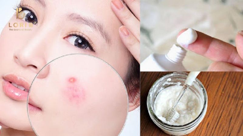 mẹo chăm sóc da sai